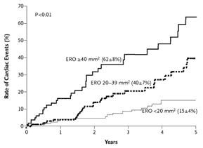 Cardiac events among patients with asymptomatic mitral regurgitation