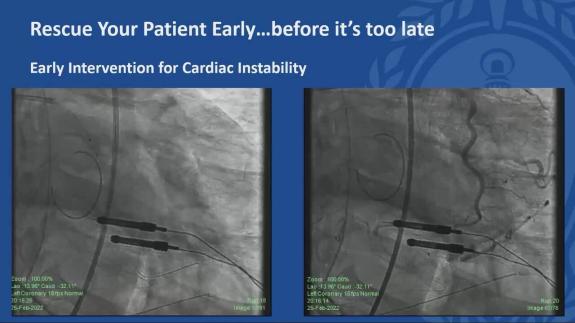 Screen capture of the video Robin Varghese: Perioperative Interventions That Have Been Proven to Improve Long-Term Outcomes