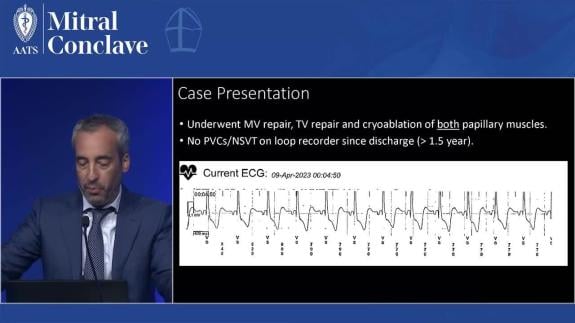 Screen capture of the video Marc Miller - Arrhythmogenic Mitral Valve Prolapse – Management