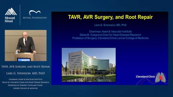 Screen capture of the video Randall B. Griepp 2017 Visiting Professor - Lars Svensson, MD