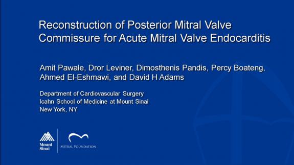 Screen capture of the video Amit Pawale: Reconstruction of Posterior Mitral Valve Commissure for Acute Mitral Valve Endocarditis