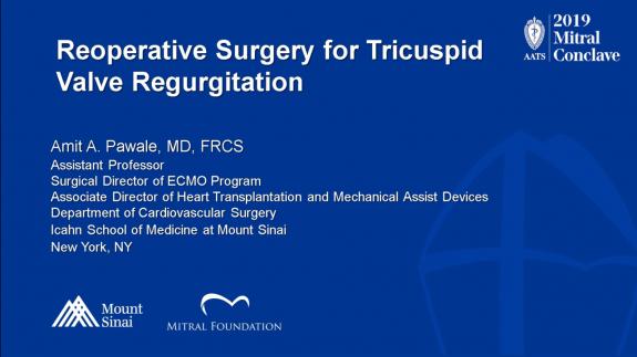 Screen capture of the video Amit Pawale: Reoperative Surgery for Tricuspid Valve Regurgitation