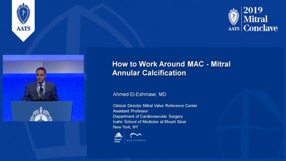 Screen capture of the video Ahmed El-Eshmawi: How to Work Around MAC - Mitral Annular Calcification