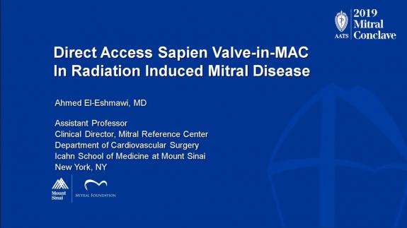 Screen capture of the video Ahmed El-Eshmawi: Direct Access Sapien Valve-in-MAC in Radiation Induced Mitral Disease