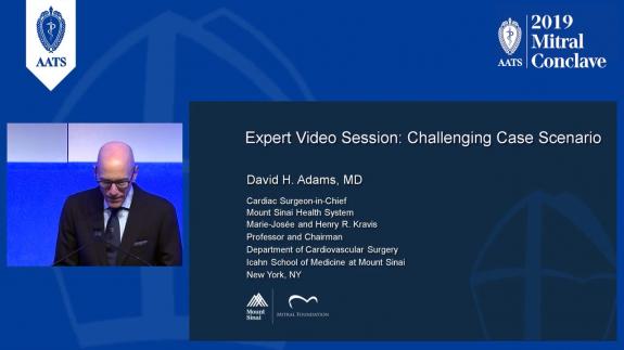 Screen capture of the video David H. Adams: Expert Video Session - Challenging Case Scenario