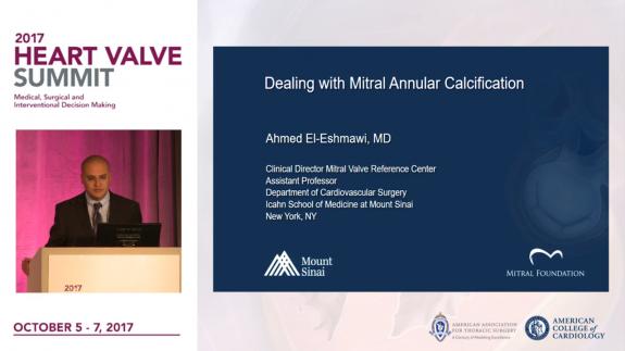 Screen capture of the video 2017 Heart Valve Summit: Dealing with Mitral Annular Calcification