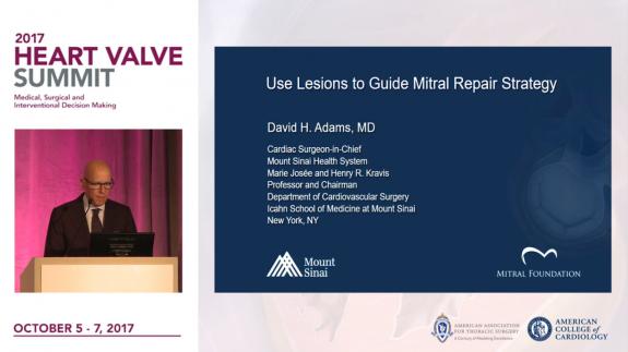 Screen capture of the video 2017 Heart Valve Summit: Use Lesion to Guide Mitral Repair Strategy