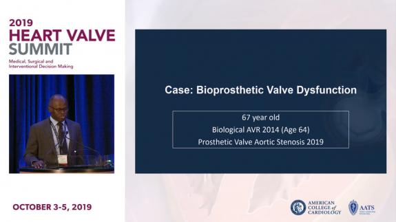 Screen capture of the video 2019 Heart Valve Summit- Case of Bioprosthetic Valve Dysfunction