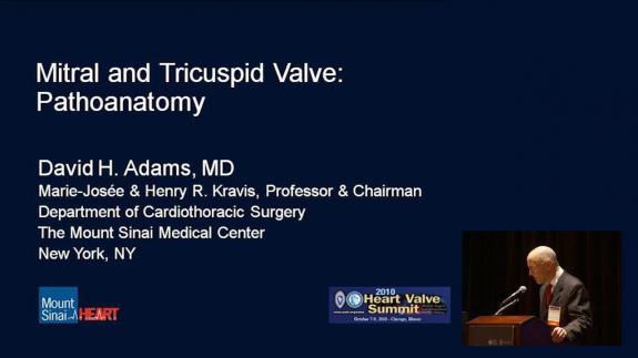 Screen capture of the video 2010 Heart Valve Summit: Mitral and Tricuspid Valve: Pathoanatomy