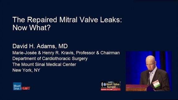 Screen capture of the video 2009 Heart Valve Summit: The Repaired Mitral Valve Leaks: Now What?