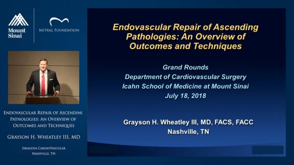 Screen capture of the video Endovascular Repair of Ascending Pathologies: An Overview of Outcomes and Techniques