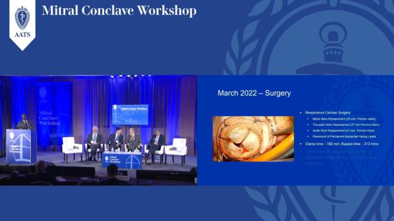 Screen capture of the video Anelechi Anyanwu: High Risk Mitral Valve Interventions – The Sick Ventricle and the Sick Patient