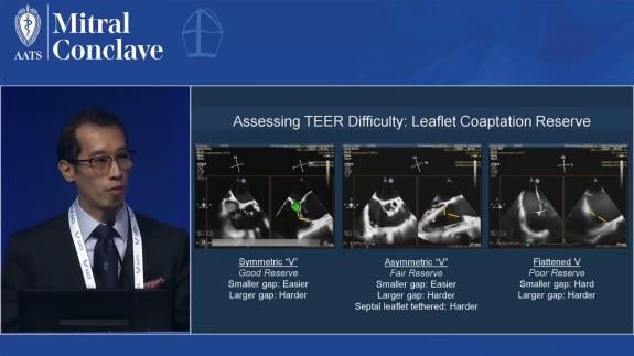 Screen capture of the video Gilbert Tang - TEER for Tricuspid Regurgitation – Evidence and Practice