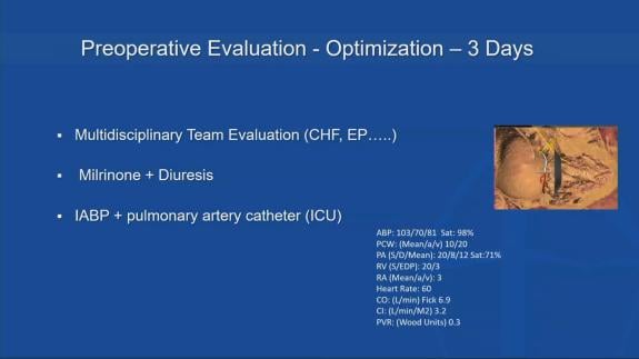 Screen capture of the video Ahmed El-Eshmawi - How I Evaluate and Optimize a High Risk Patient for Valve Surgery