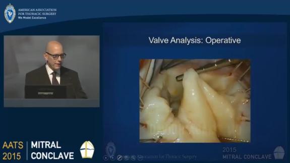 Screen capture of the video David H. Adams: Valve Analysis and Lesions