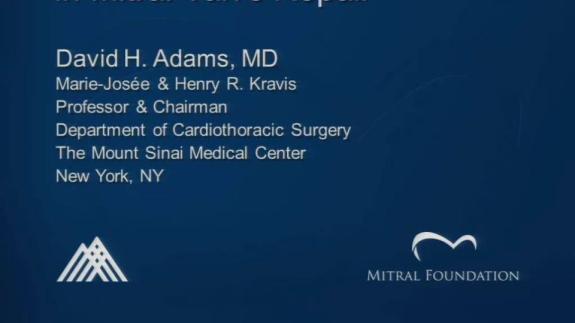 Screen capture of the video David H. Adams: Pericardial Patch Augmentation in Mitral Valve Repair