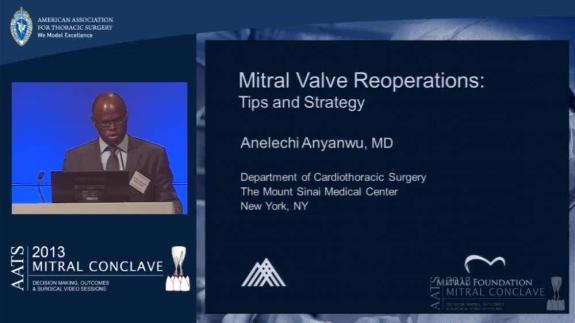 Screen capture of the video Anelechi Anyanwu: Mitral Valve Reoperations: Tips and Strategy