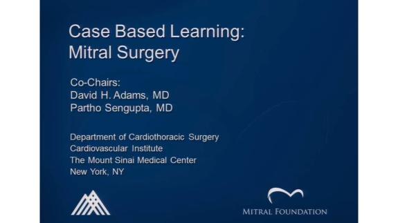 Screen capture of the video David H. Adams and Parth Sengupta: Case Base Learning: Mitral Surgery