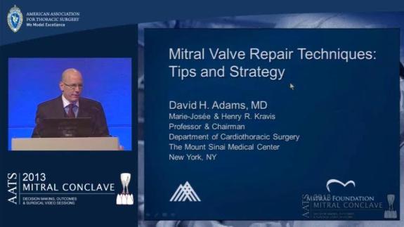Screen capture of the video David H. Adams: Mitral Valve Repair Techniques: Tips and Strategy