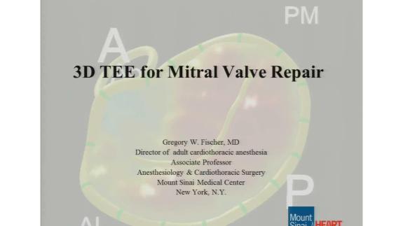 Screen capture of the video Gregory W. Fischer: 3D TEE for Mitral Valve Repair