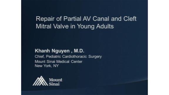 Screen capture of the video Khanh Nguyen: Repair of Partial AV Canal and Cleft Mitral Valve in Young Adults