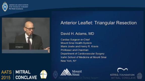Screen capture of the video David H. Adams: Anterior Leaflet- Triangular Resection