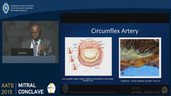 Screen capture of the video Anelechi Anyanwu: Coronary Complications