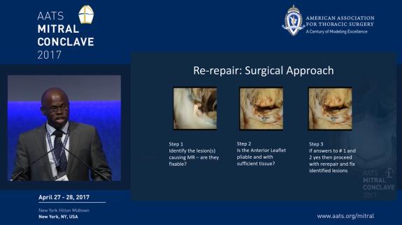 Screen capture of the video Anelechi Anyanwu: Re-Repair: Surgical Approach