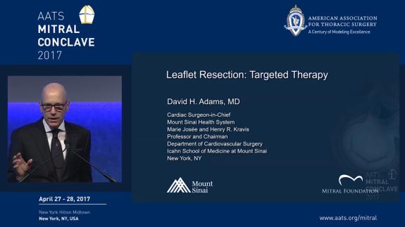 Screen capture of the video David H. Adams: Leaflet Resection - Targeted Therapy