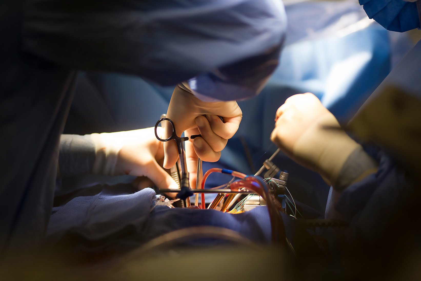 Mitral valve repair operation at The Mount Sinai Hospital